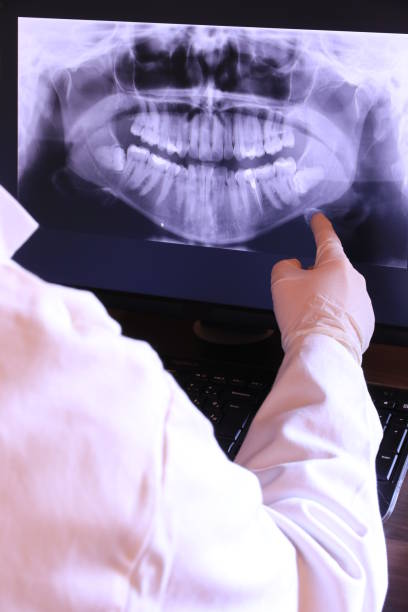 Best Emergency Tooth Extraction in Weston Lakes, TX