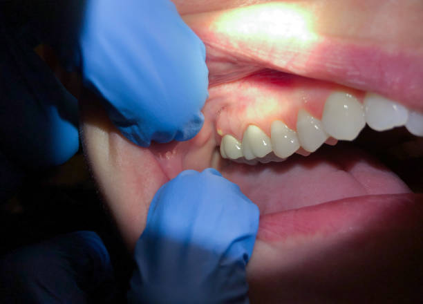 Best Pediatric Emergency Dentist in Weston Lakes, TX